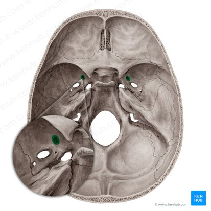 <p>round opening in the sphenoid bone</p>