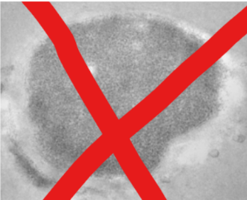 <p><span style="background-color: transparent;"><span>unstained cells</span></span></p>