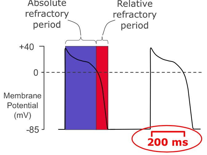 <ul><li><p>Slow depolarisation of the membrane  = lag time = refilling needed for the heart </p></li></ul>