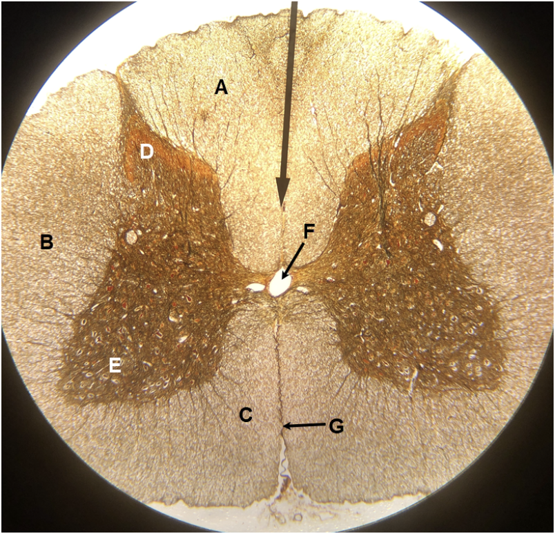 <p><span><span>In the image above, identify structures A-G. Question H: the cell bodies of what type of neurons are located in structure E?</span></span></p>