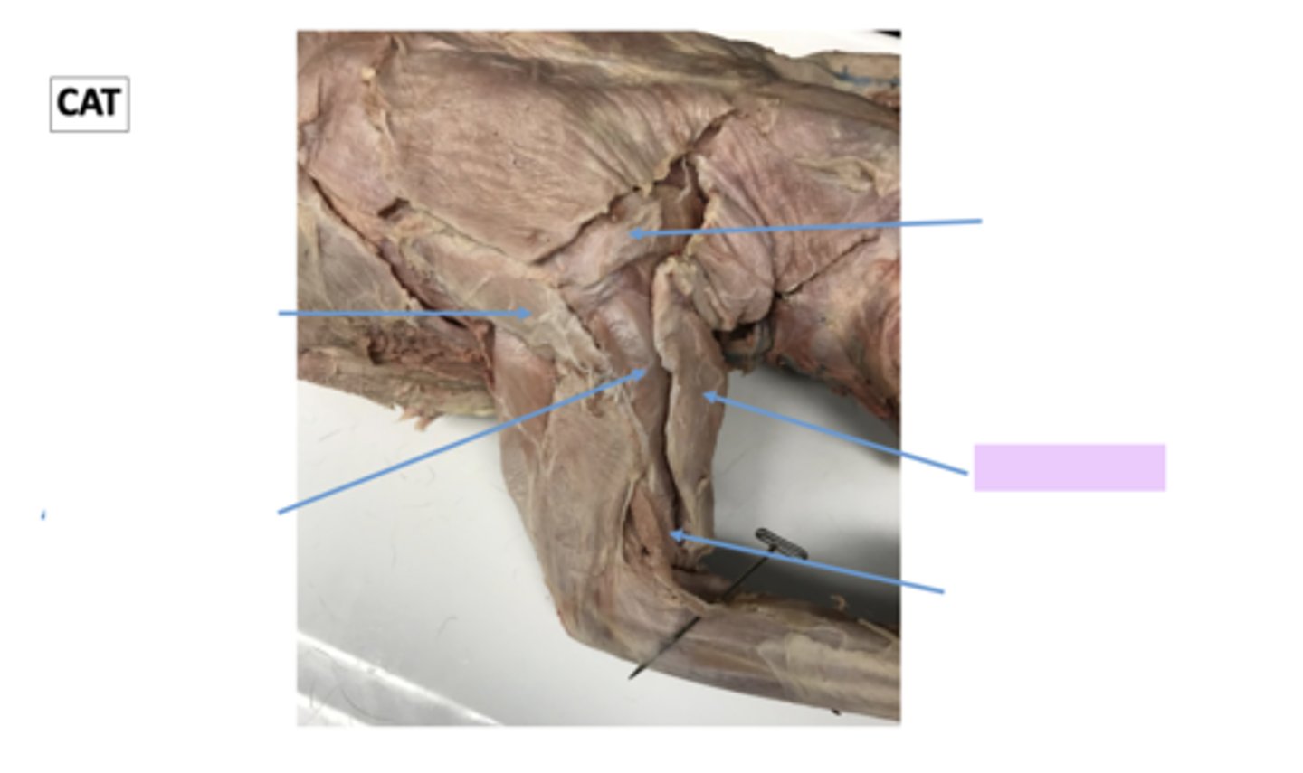 <p>name this muscle</p>
