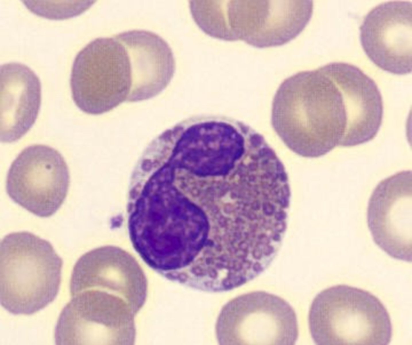 <p>2 or 3 lobes</p>