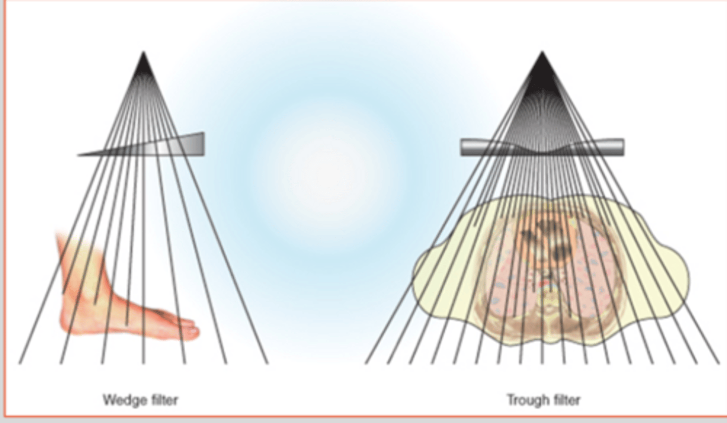 <p>the intensity of x-ray beam to deliver more uniform exposure to the detector</p><p>Wedge (spine and foot)</p><p>Trough (chest)</p><p>ClearPbTM: clear lead, some aspect of filtration</p>
