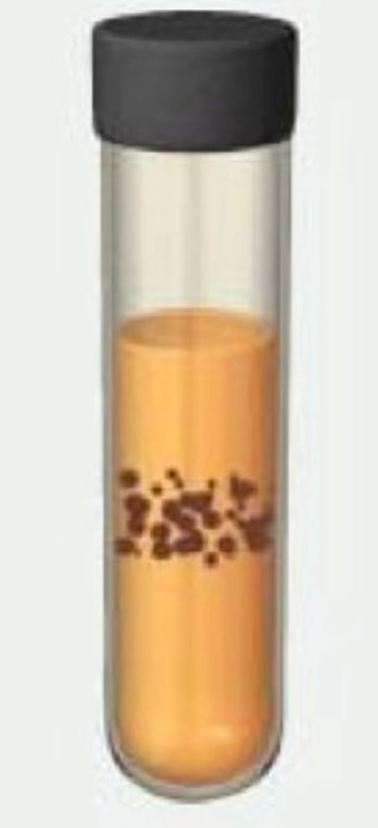 <p>name what kind of microbe in the test tube and describe the growth pattern</p>