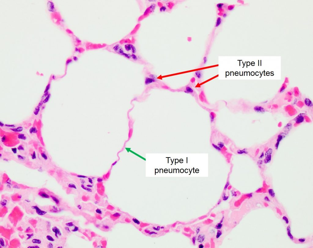 <p>Pneumocyte type 1</p>