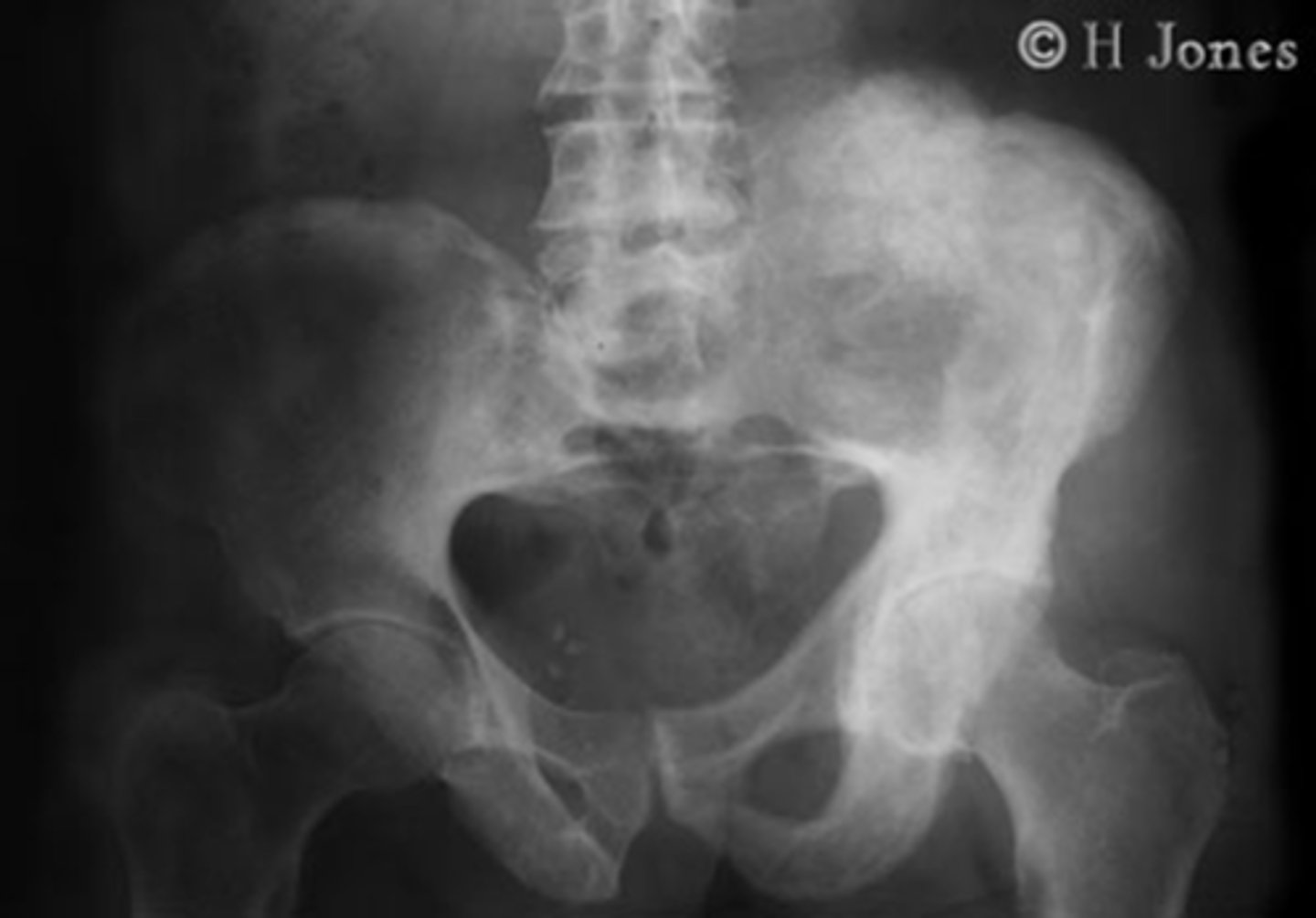 <p>What kind of pathology is present in this image</p>