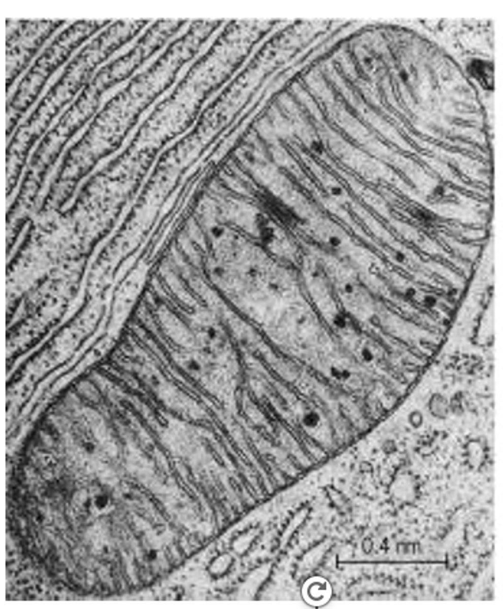 <p>What is seen in mitochondria under electron microscopy?</p>