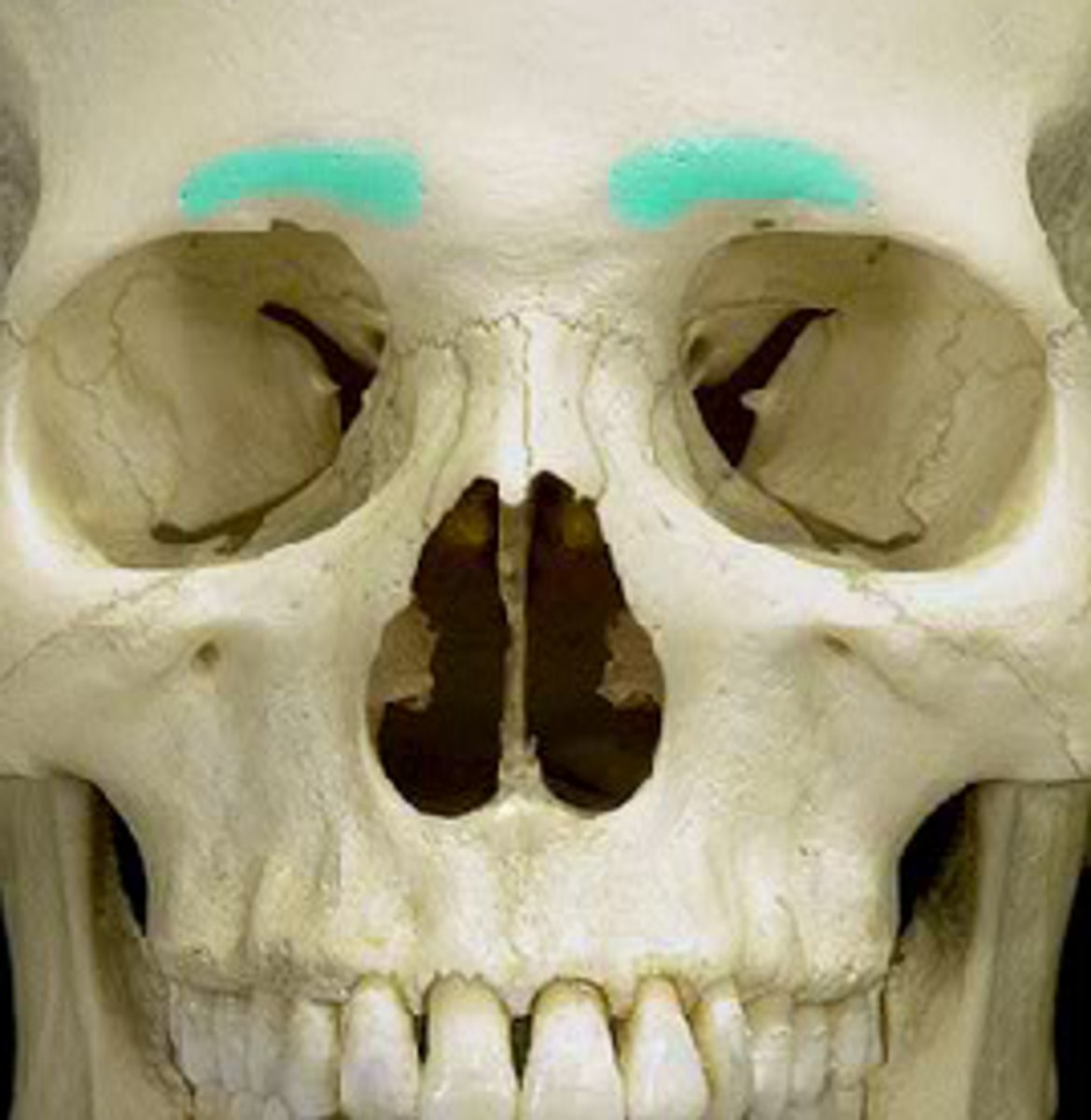 <p>Brow ridge above the eye sockets.</p>