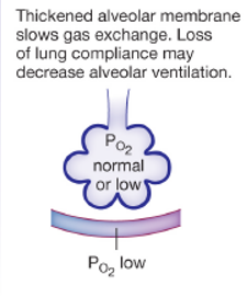 <p>what disease state does this represent</p>