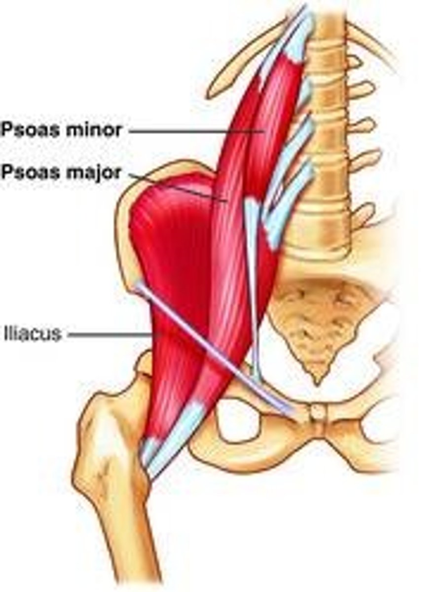 <p>Name this muscle</p>