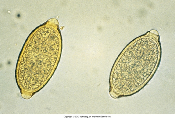 <p>canine and feline bronchi, trachea inflammatory response</p>