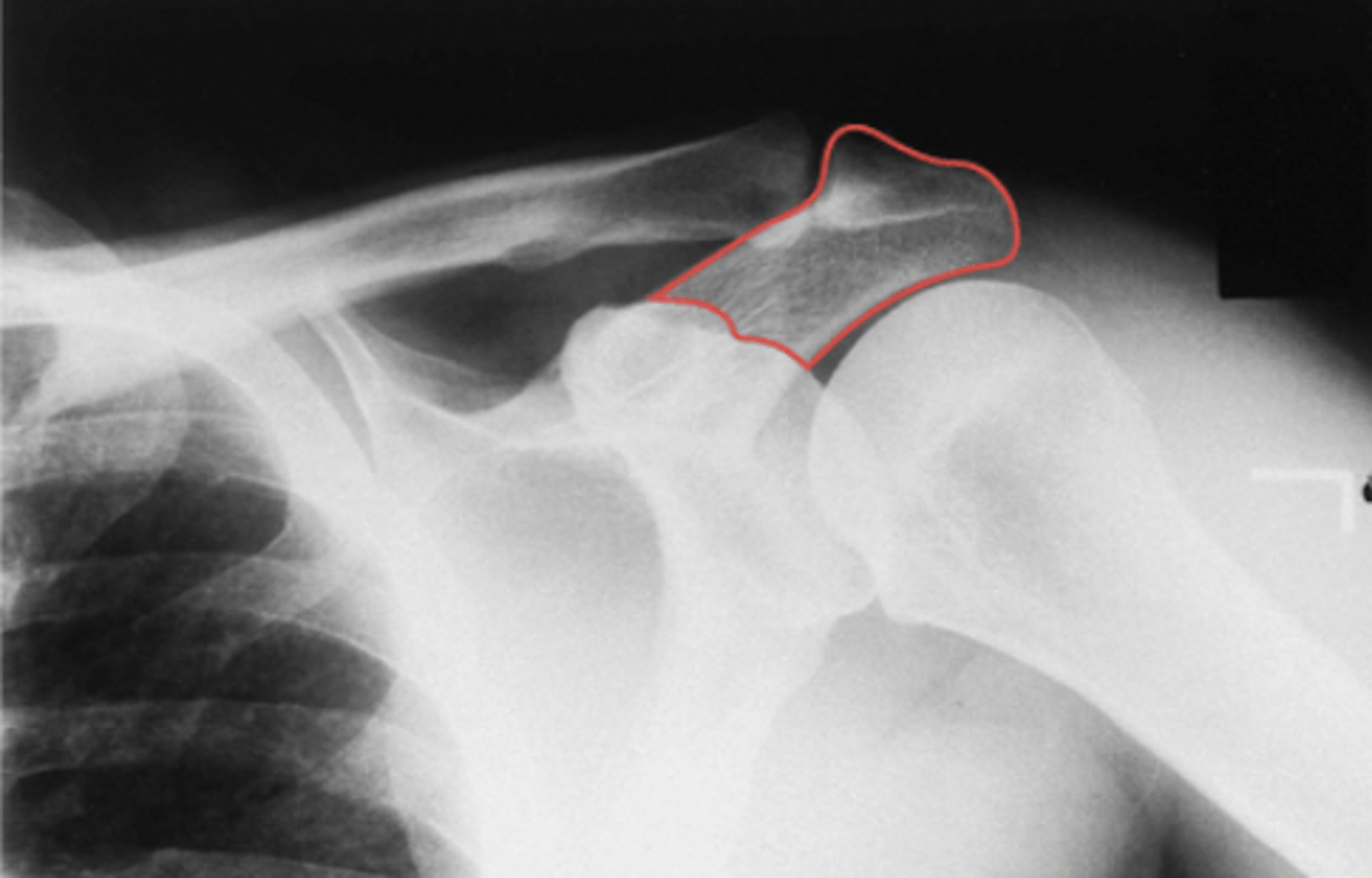 <p>What structure is highlighted?</p>