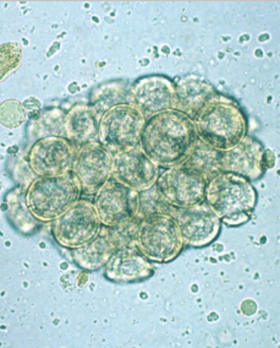 <p>These egg packets were found in the fecal sample of a 10 year old Yorkshire Terrier. What parasites are these eggs associated with?</p>