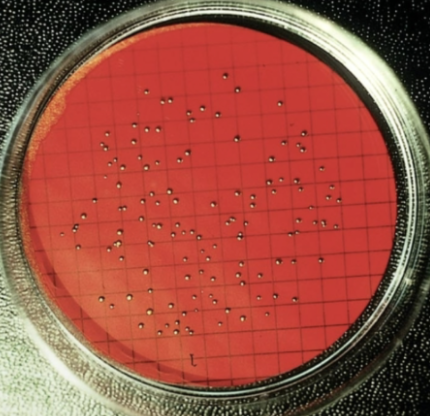 <ol><li><p>bacteria <strong>low conc </strong>(i.e. water)</p></li><li><p><strong>100ml water</strong> filtered thru <strong>mem w holes </strong></p></li><li><p>those stuck on mem incubated & counted </p></li></ol><p></p>