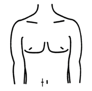 <ul><li><p>vertical skinfold</p></li><li><p>2 cm lateral of belly button</p></li></ul><p></p>