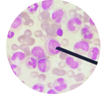 <p>what kind of white blood cells is this?</p>