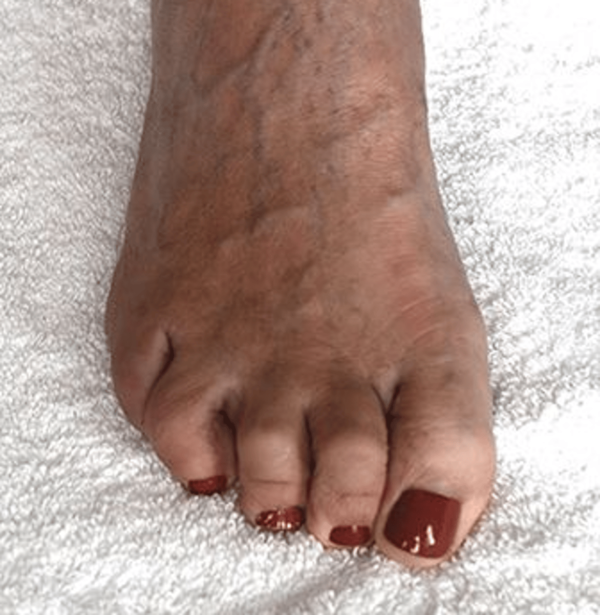 <p>1. High toe box</p>