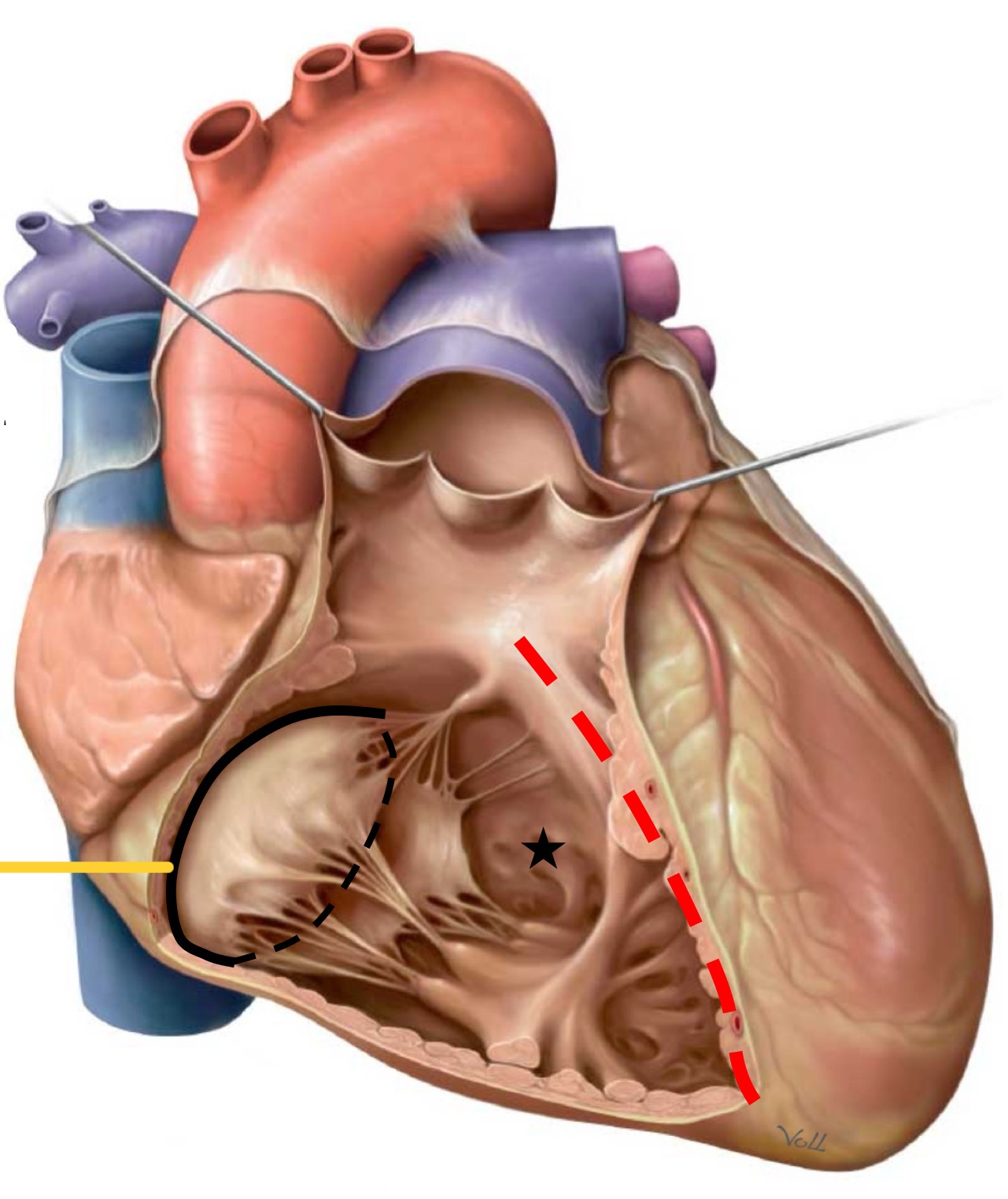 <p>What structure is identified by the black star?</p>