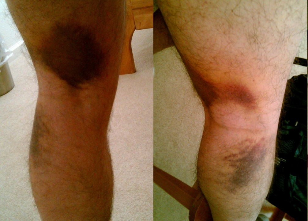 <p>marked or discolored, usually by a substance that is difficult to remove.<br></p>