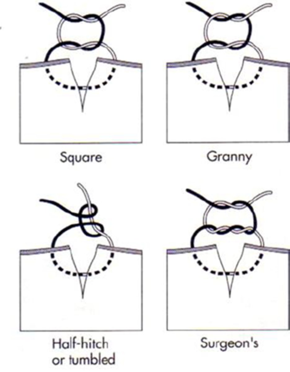 <p>various knot conformations depends on tissue and suture material</p>