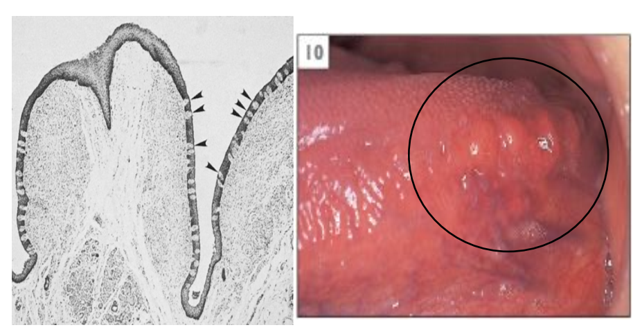 <p>Describe Foliate Papillae</p>