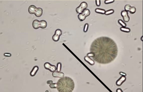 <p>Identify structure found in alkaline urine.</p><p></p>