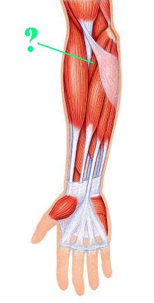 <p><span>Identify the indicated muscle.</span></p>