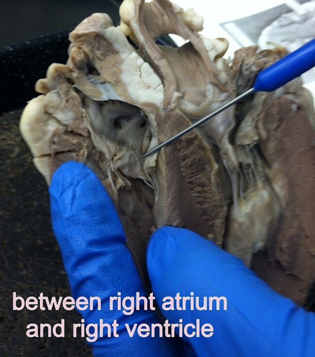 <p>Identify this valve (NOTE, anterior view)</p>