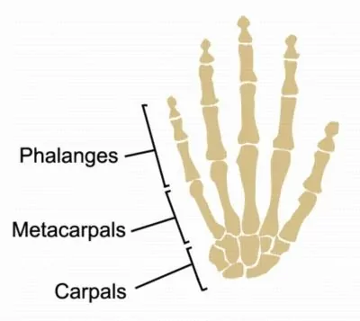 <p>What bone is this?</p>