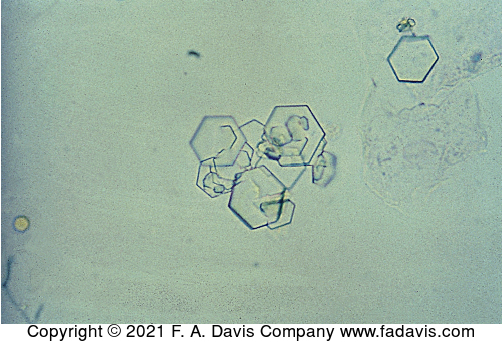 <p>Name this crystal? what is it associated with? what is its ph? normal or abnormal?</p>