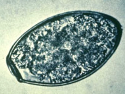 <p>Paragonimus kellicotti - lung fluke (egg)</p>