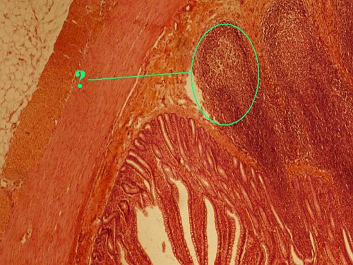 <p>Identify the indicated structures in the ileum.</p>