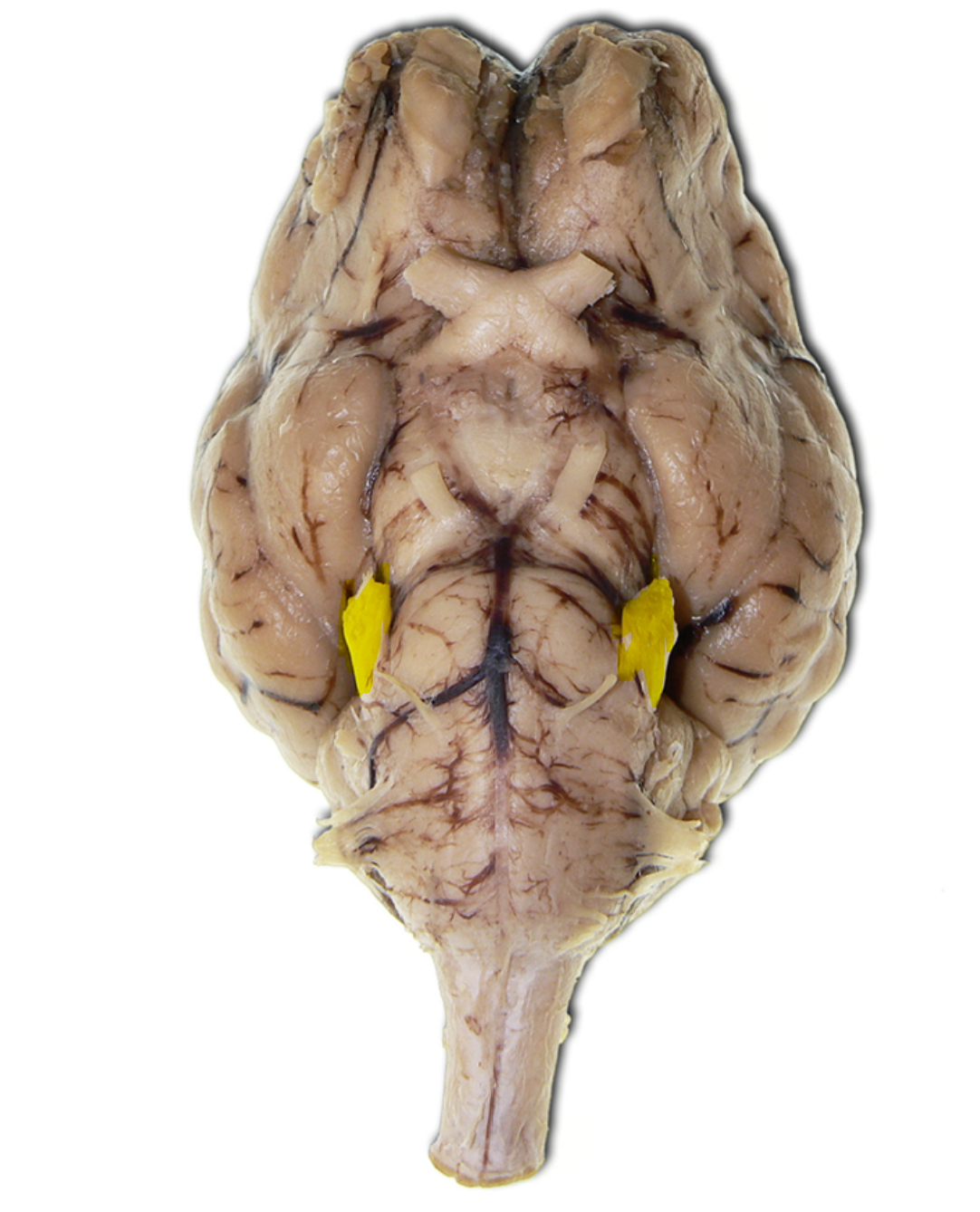 <p>Name the part of the brain highlighted in yellow.</p>