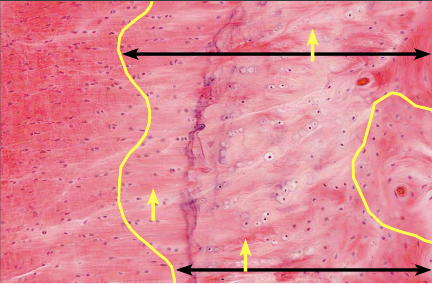 <p>What tissue is found to the left of the yellow line, in between the black arrows, and in the yellow circle?</p>