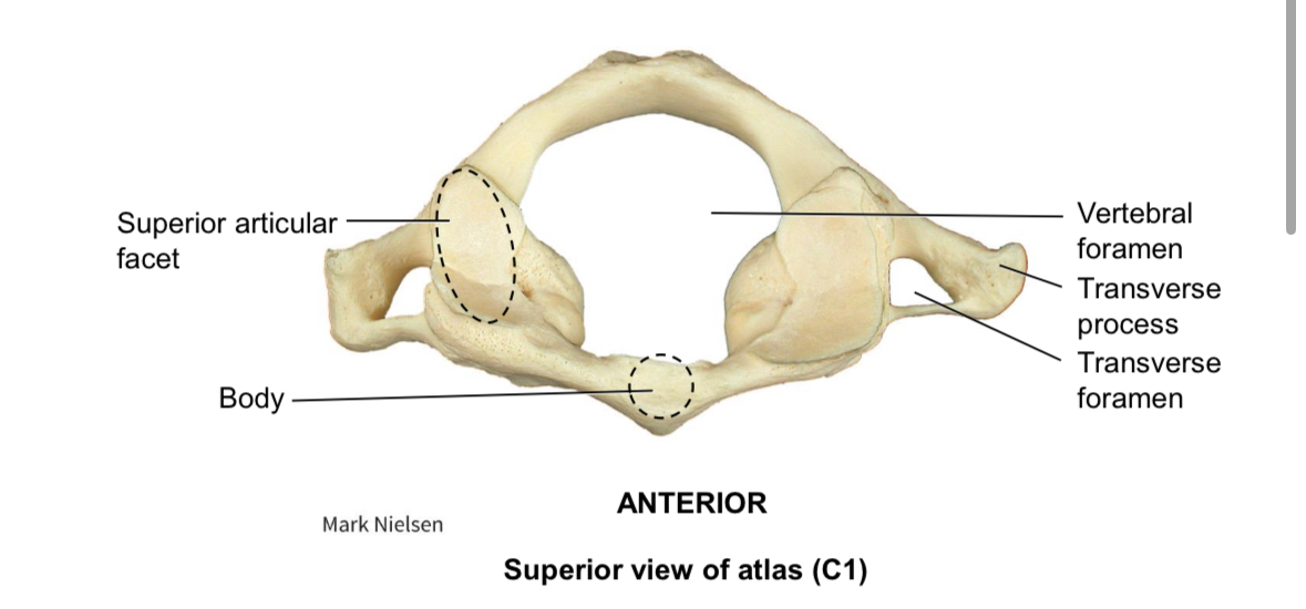 <p>Atlas C1</p>
