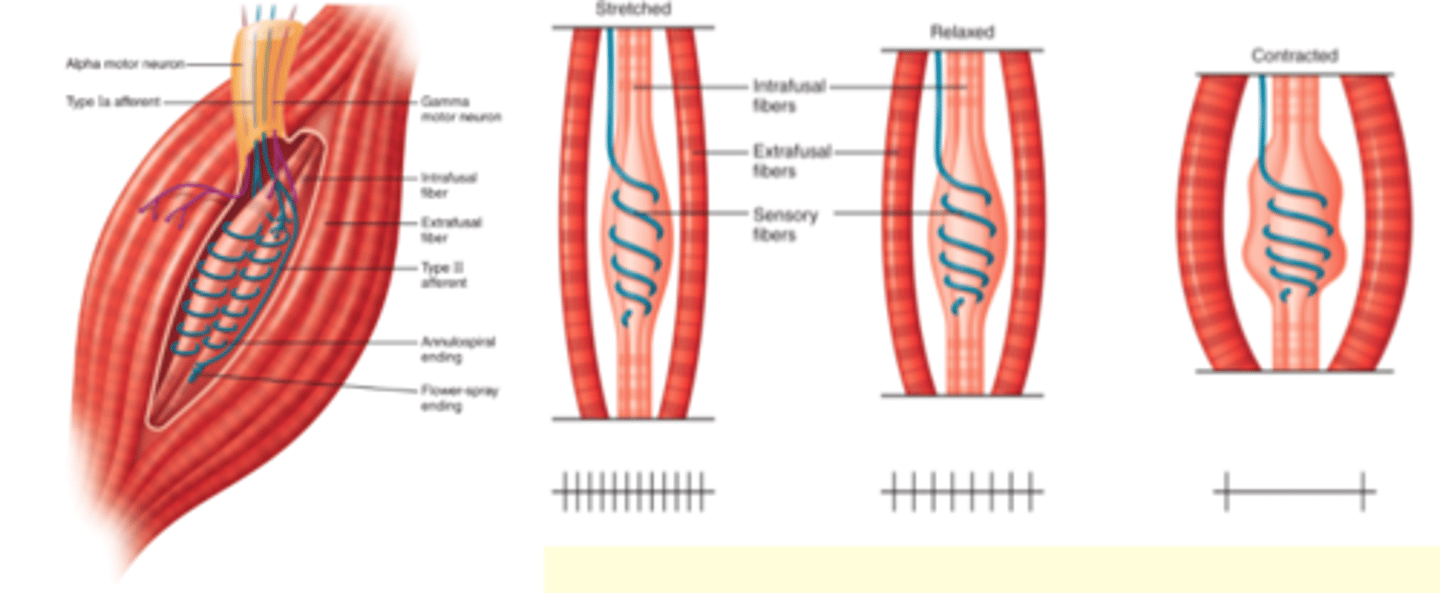 <p>Intrafusal muscle fibres: only have actin-mysoin across the two ends and can only contract at the end</p><p>- site of length detection; have sensory neuron wrapped around them</p><p>stretch reflex: (spinal cord/butterfly)</p><p>1a firing rate</p><p>really fast firing rate: it causes contraction of the muscle cells - negative feedback loop</p><p>regular muscle cell: (innervated by ∂-motor neuron) extrafusal muscle</p><p>flopy intrafusal fibre (see picture: contracted) loss length sensor; lost excitatory neuron drive/not responsive to other signals/less excitable</p>