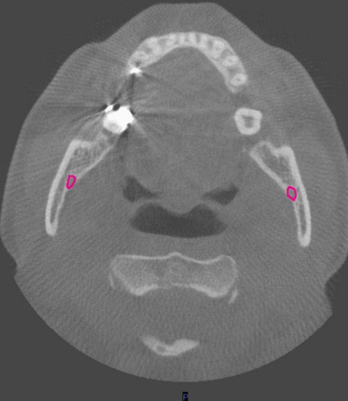 <p>identify structure</p>