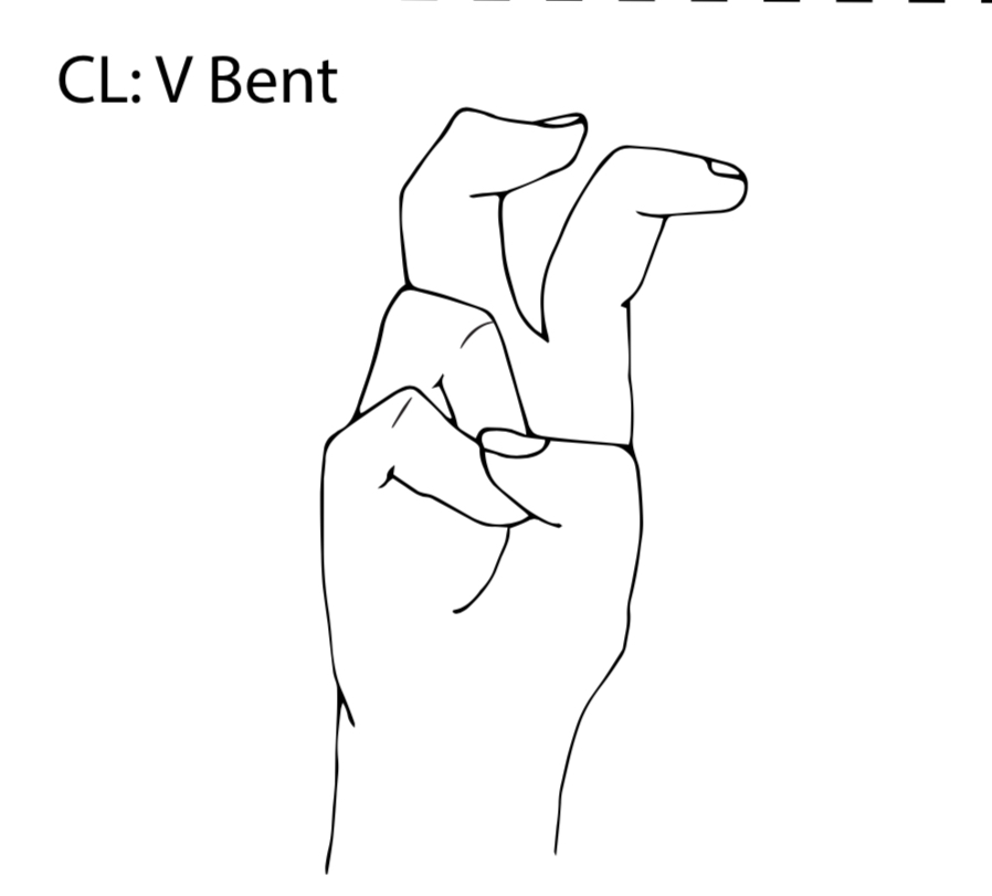 <p>What is a CL: V Bent classifier?</p>