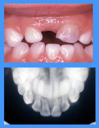 <p>what do these images show </p>
