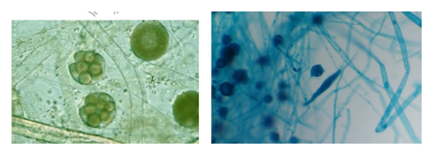 <p>What is the GENUS of this organism?</p>