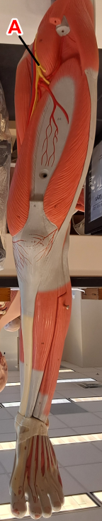 <p>determine the leg nerve on label A</p><p></p><p>wordbank: common fibular, femoral nerve, sciatic nerve, tibial nerve</p>