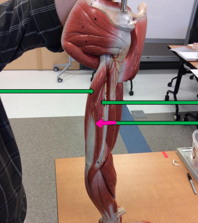 <p>Identify this muscle?</p>