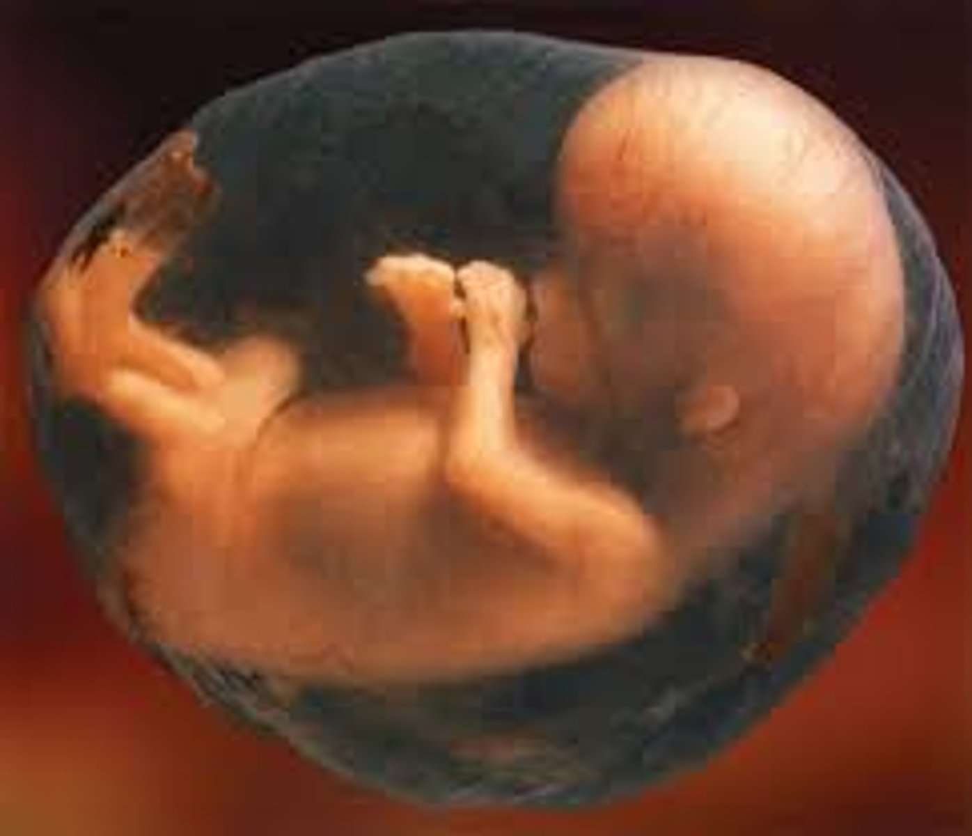 <p>fetus</p>