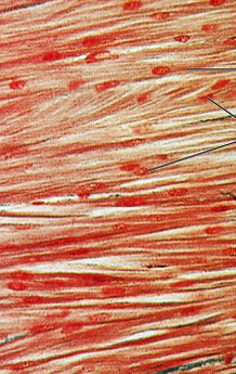 <p>what is the muscle tissue?</p>