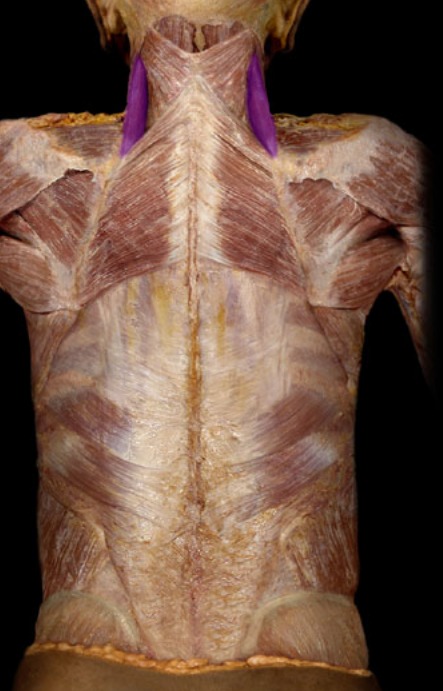 <p>narrow muscle, runs down neck and towards scapula; deep to trapezius</p>