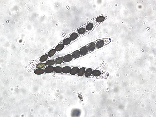 <p>Haploid spores are produced in the sac-like asci</p>