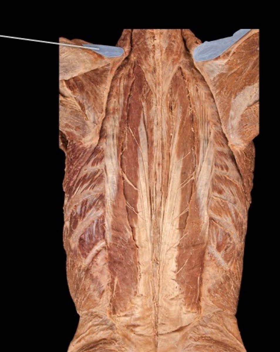 <p>What muscle is this?</p>