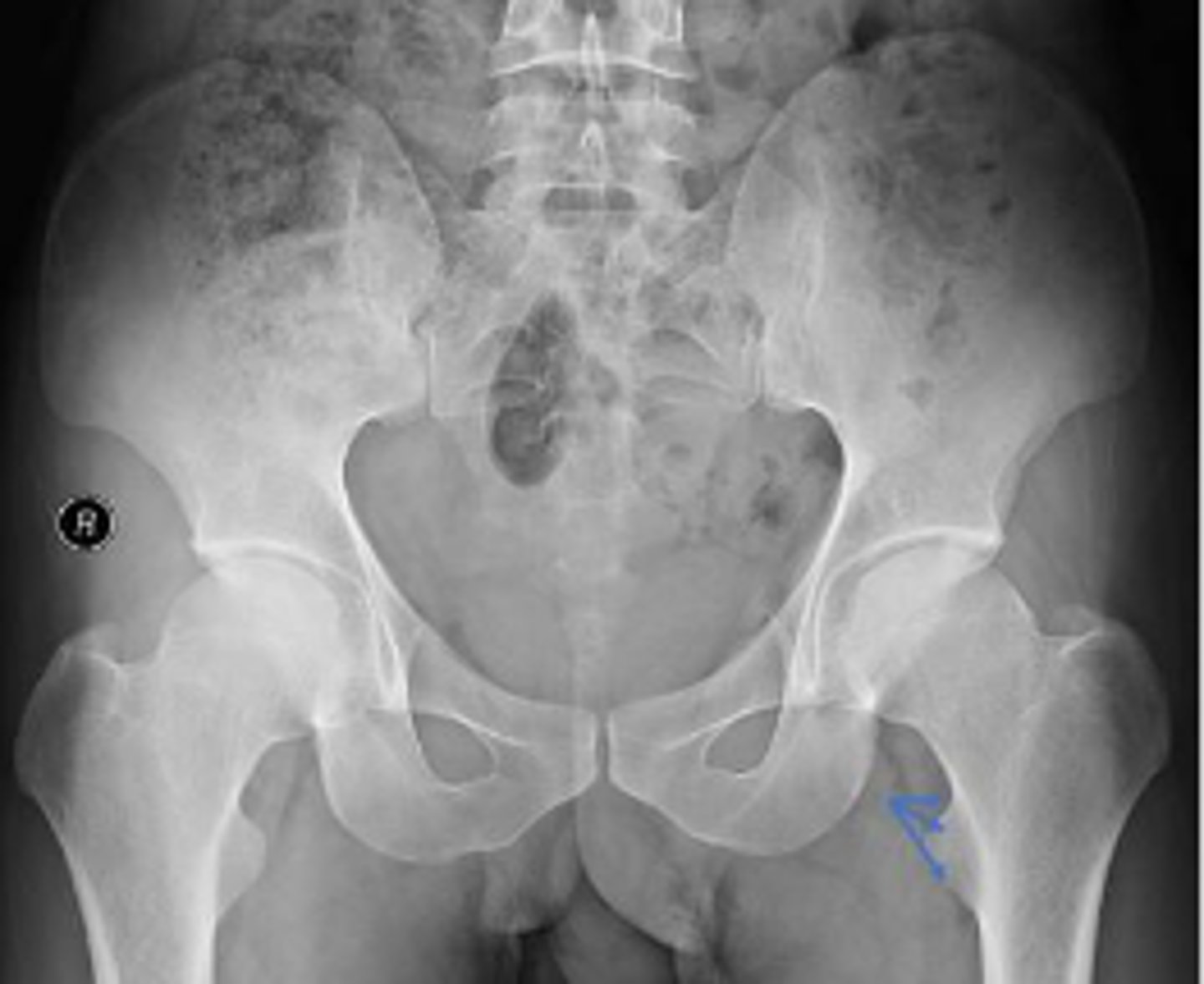 <p>Name 2 structures that are attached to this area?</p>