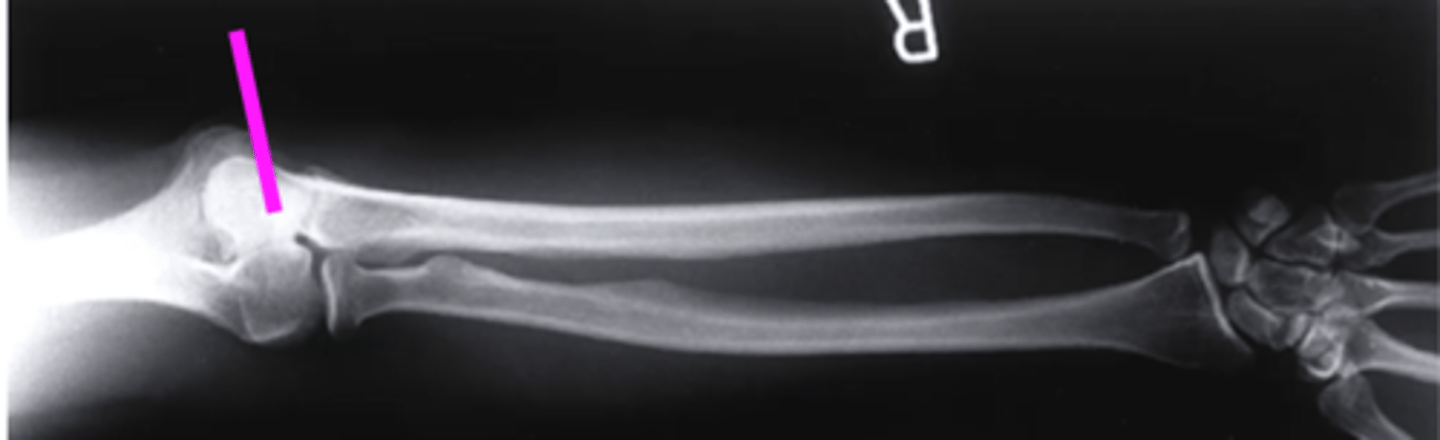 <p>what does this pink line point to?</p>