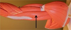 <p>Posterior arm muscle that controls movement in the lower arm, origin at scapula/humerus, insert at ulna</p>